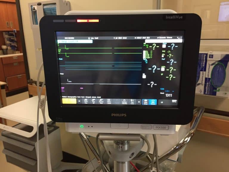 New Cardiac Bedside Monitor at Oceanside Health Centre